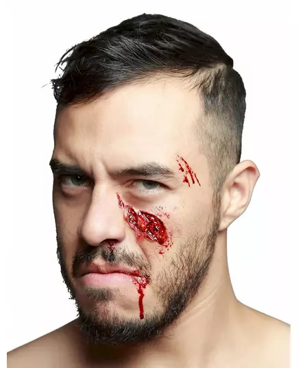 Falešné zranění propadlé lícní kosti